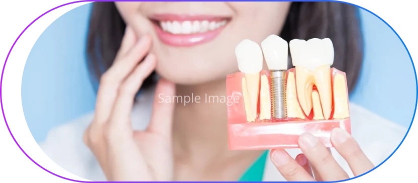 What are Dental Implants?