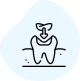 Dental Filling