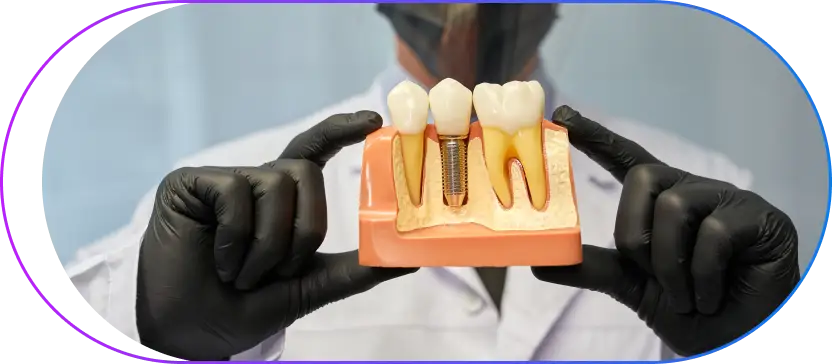Implantology Implantology