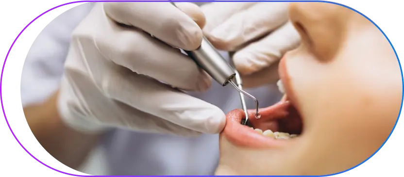 Why Dental Scaling is Great for You? Why Dental Scaling is Great for You?