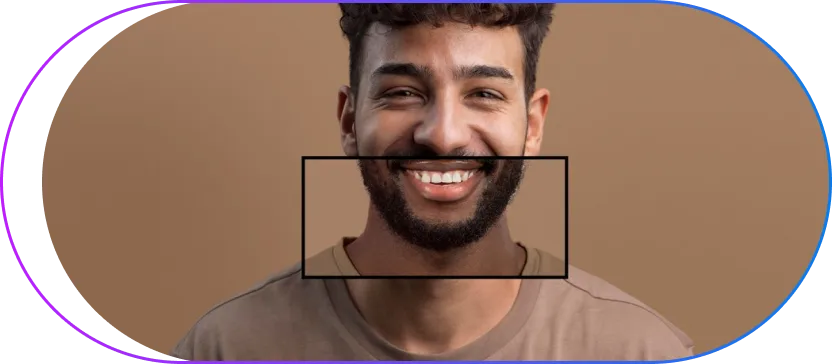 Benefits of Teeth Whitening Benefits of Teeth Whitening
