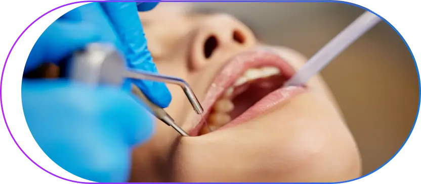 Benefits of Teeth Scaling Benefits of Teeth Scaling