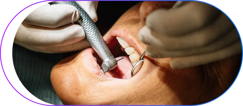 Dental Scaling in Kolkata Dental Scaling in Kolkata