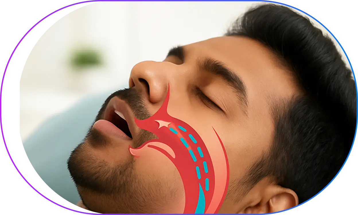 Sleep Apnea Treatment Sleep Apnea Treatment