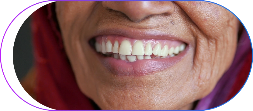 Full Mouth Reconstruction In Kolkata Full Mouth Reconstruction In Kolkata