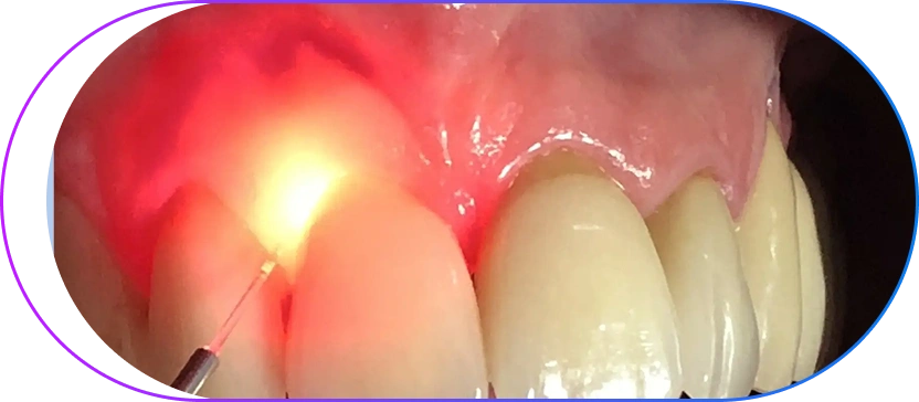 Advanced Treatment Options Advanced Treatment Options