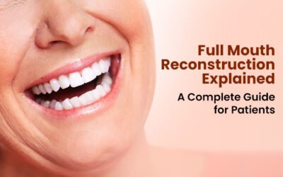 Full Mouth Reconstruction Explained – A Complete Guide for Patients