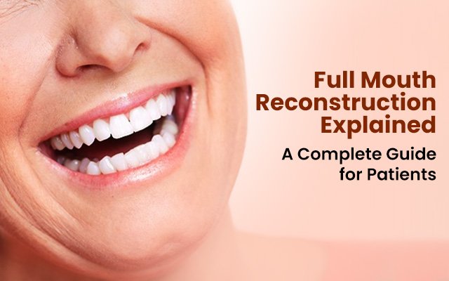 Full Mouth Reconstruction Explained – A Complete Guide for Patients