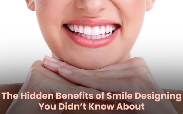 Benefits of Smile Designing