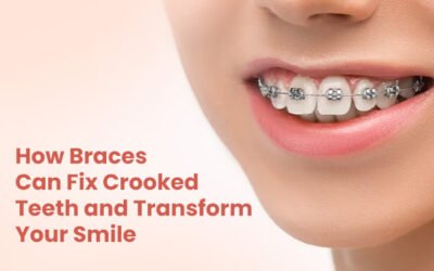How Braces Can Fix Crooked Teeth and Transform Your Smile