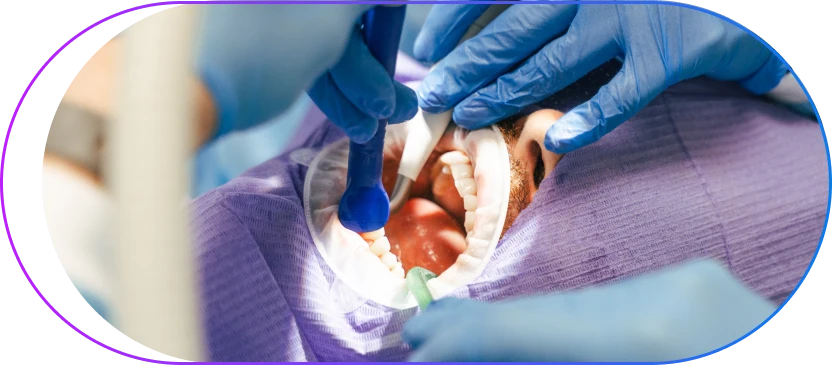 Microscope Root Canal Aftercare