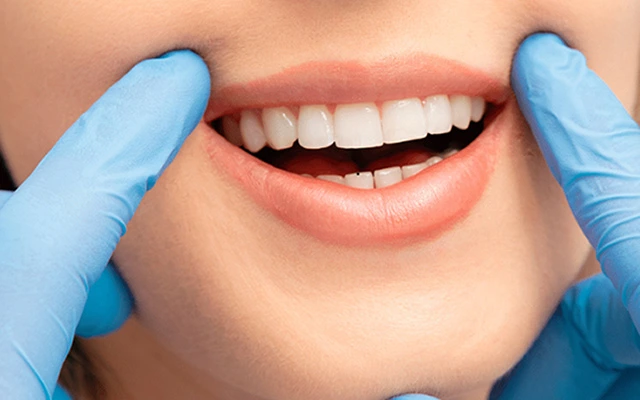 Laser vs. Zoom Whitening