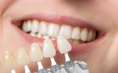 Side Effects of Teeth Whitening: What’s Normal, What’s Not & When to Take It Seriously