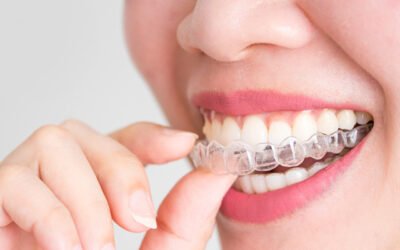 Eating, Drinking & Daily Life with Invisible Dental Braces: What to Expect (Real Routine Guide)