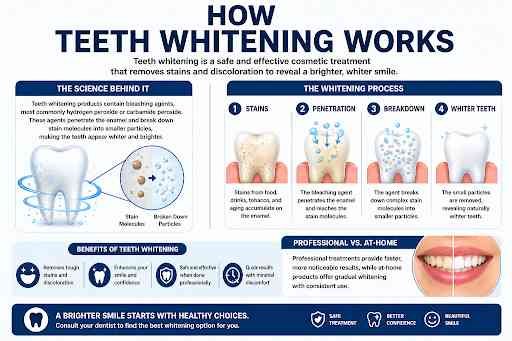 Teeth Whitning Process