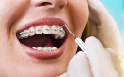 Who Needs Orthodontic Treatment? 10 Signs You Shouldn’t Ignore