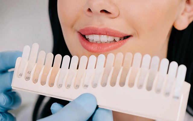 Understanding Teeth Whitening